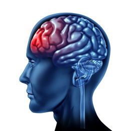 traumatic-brain-injury.jpg
